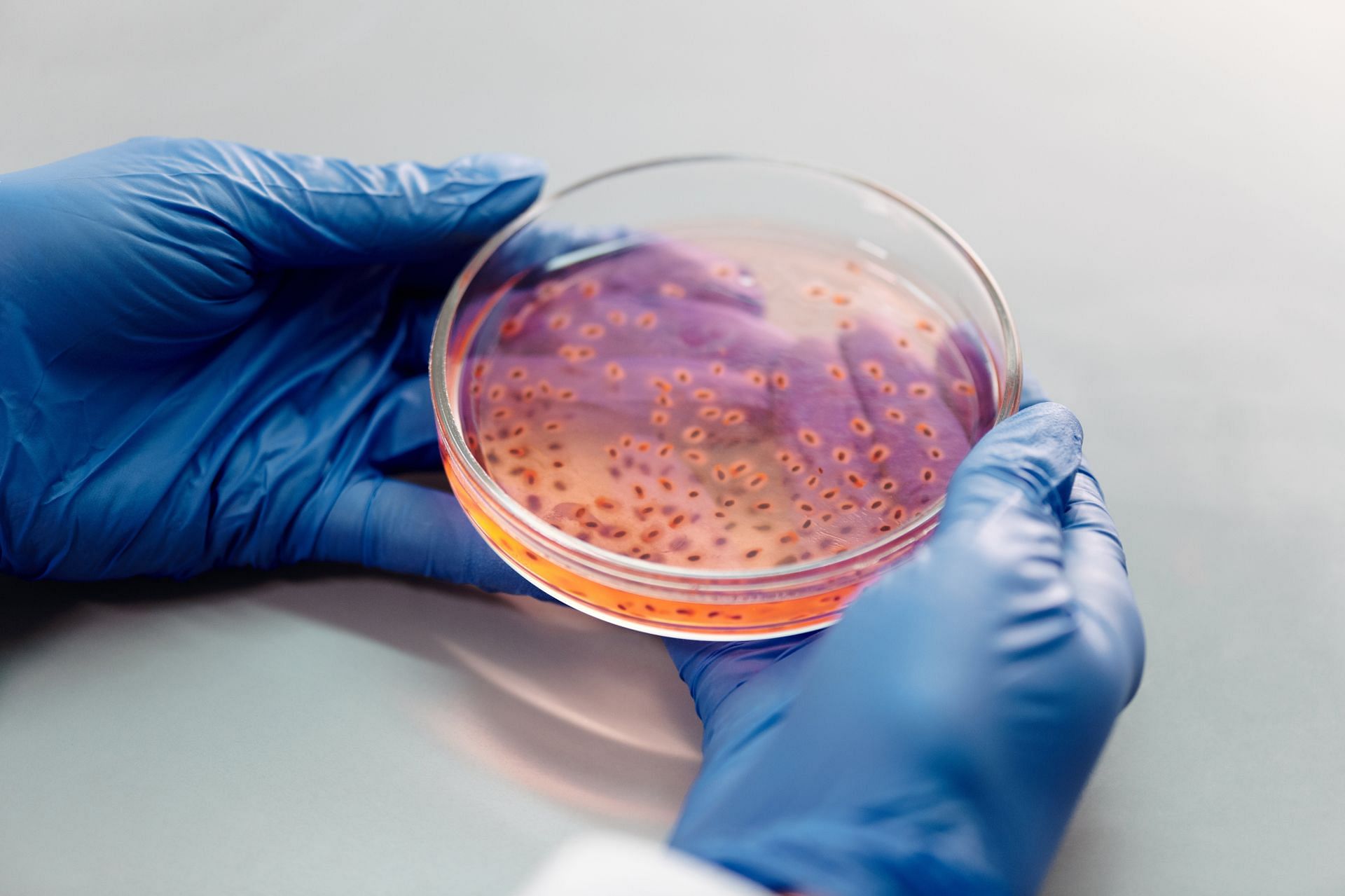 White lung pneumonia (Image sourced via Pexels / Photo by edward-jenner)